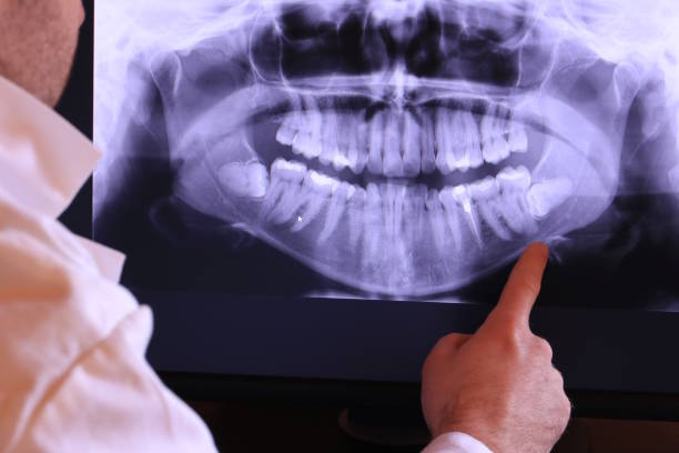 Best Mobile Emergency Dentist in Innotion, VA