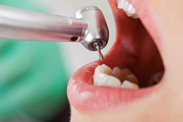 Best Weekend Emergency Dentist in Innotion, VA